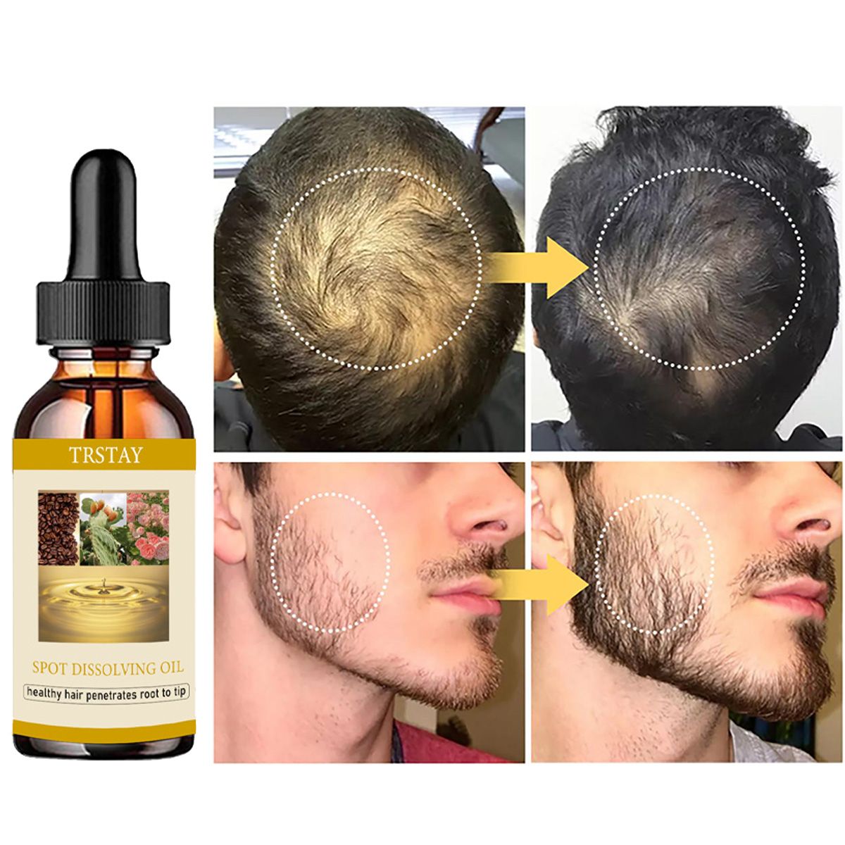 50ML Beard Growth Oil Anti Alo - огляд і ціна Beard Oil